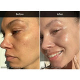 Medicube Deep Vita C Capsule Cream | Brightening Vitamin C Moisturizer