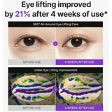 Centellian24 360° Shot PDRN Lifting Eye Cream | Anti-Aging Eye Cream for Wrinkles, Puffiness & Dark Circles | Firming & Hydrating Formula | 30ml